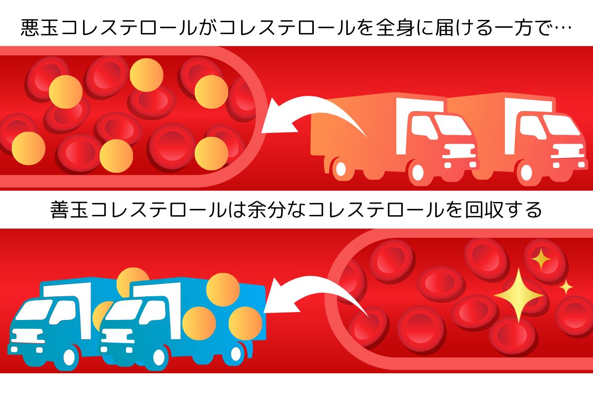 悪玉と善玉コレステロール